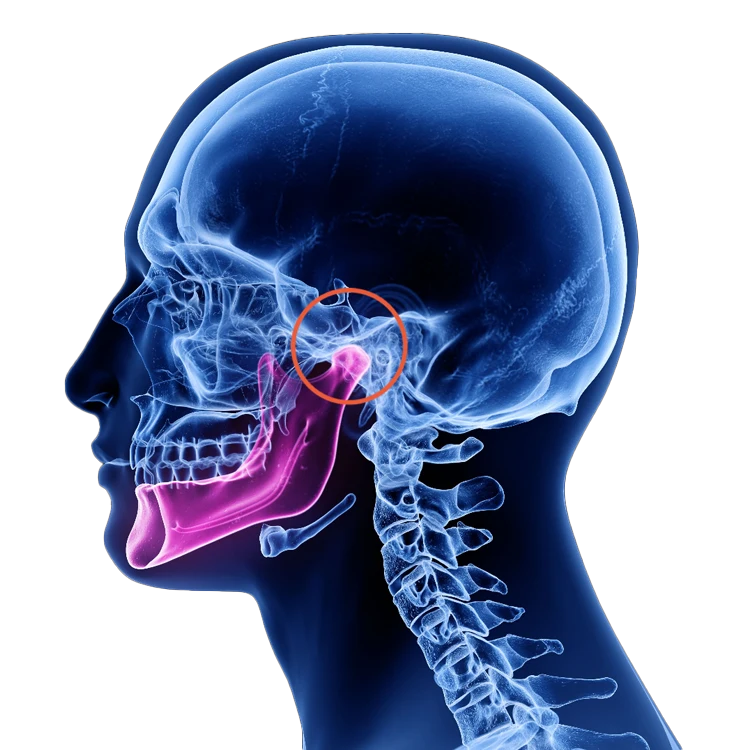 Concussion Specialist Philadelphia PA Jaw Joint Science Institute HP BG x-ray of the skull highlighting the TMJ